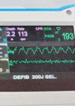 Adult Advanced Life Support